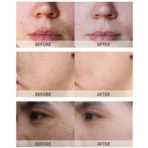 Anti-inflammatory skincare