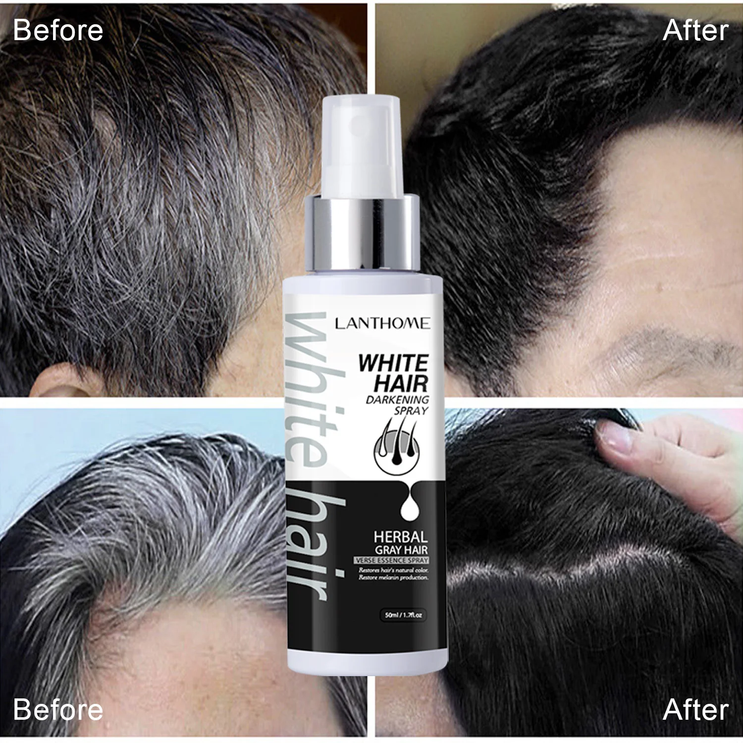 Hair growth promotion Hair growth promotion