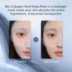 Wrinkle Reduction Mask