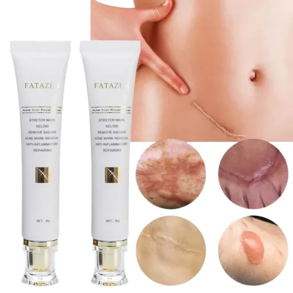 Acne marks remover