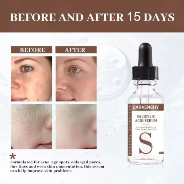 Brightening skin serum