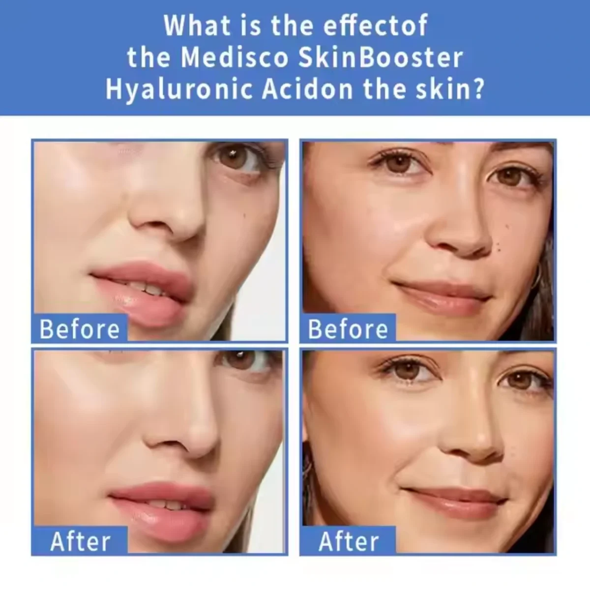 Hydrating serum