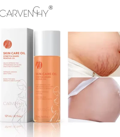 Natural Stretch Mark Oil