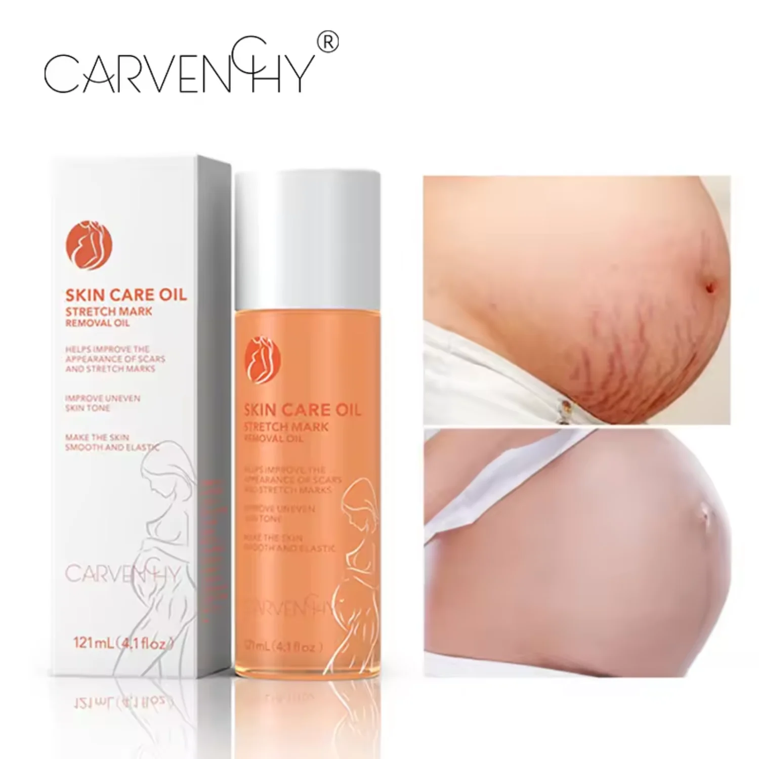 Natural Stretch Mark Oil Natural Stretch Mark Oil