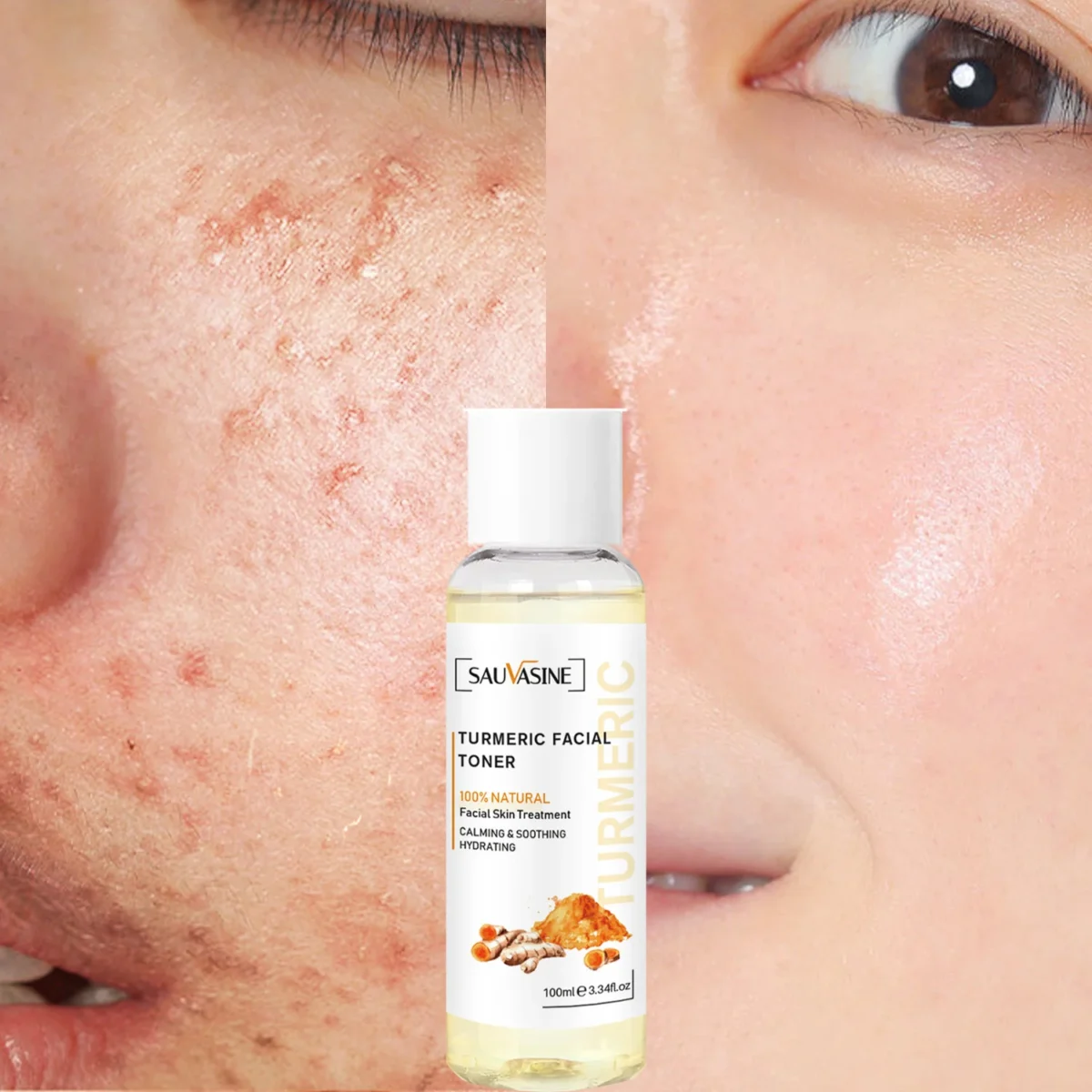 Pore tightening