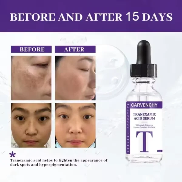 Skin Whitening Serum