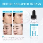 Skin firmness enhancer