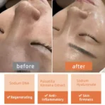 Skin regeneration ampoule